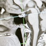 découvrez la médecine fonctionnelle, une approche holistique qui vise à traiter les causes profondes des maladies en prenant en compte l'individu dans sa globalité. obtenez des conseils sur les modes de vie, l'alimentation et bien plus pour optimiser votre santé.