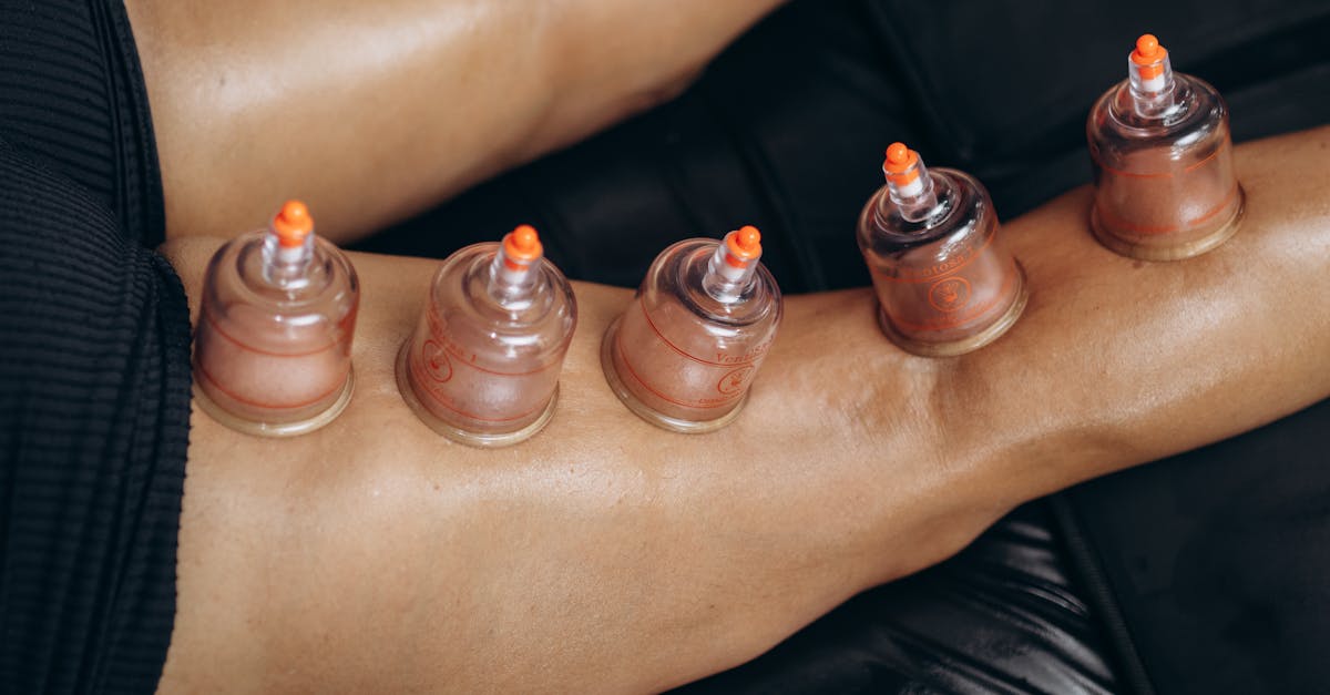 la médecine fonctionnelle est une approche de santé personnalisée qui vise à identifier et traiter les causes sous-jacentes des maladies plutôt que de se concentrer uniquement sur les symptômes. découvrez comment cette méthode holistic peut améliorer votre bien-être et favoriser une meilleure qualité de vie.