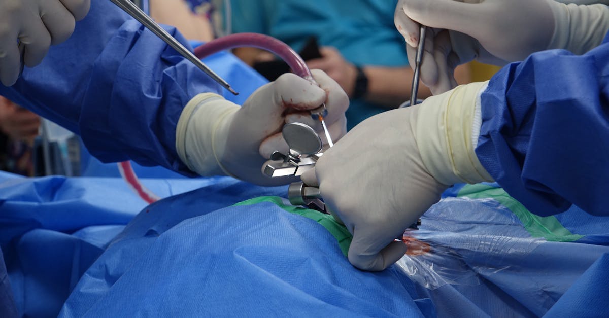 découvrez la décompression spinale, une approche thérapeutique innovante pour soulager les douleurs lombaires et cervicales. améliorez votre qualité de vie grâce à des techniques non invasives et efficaces.