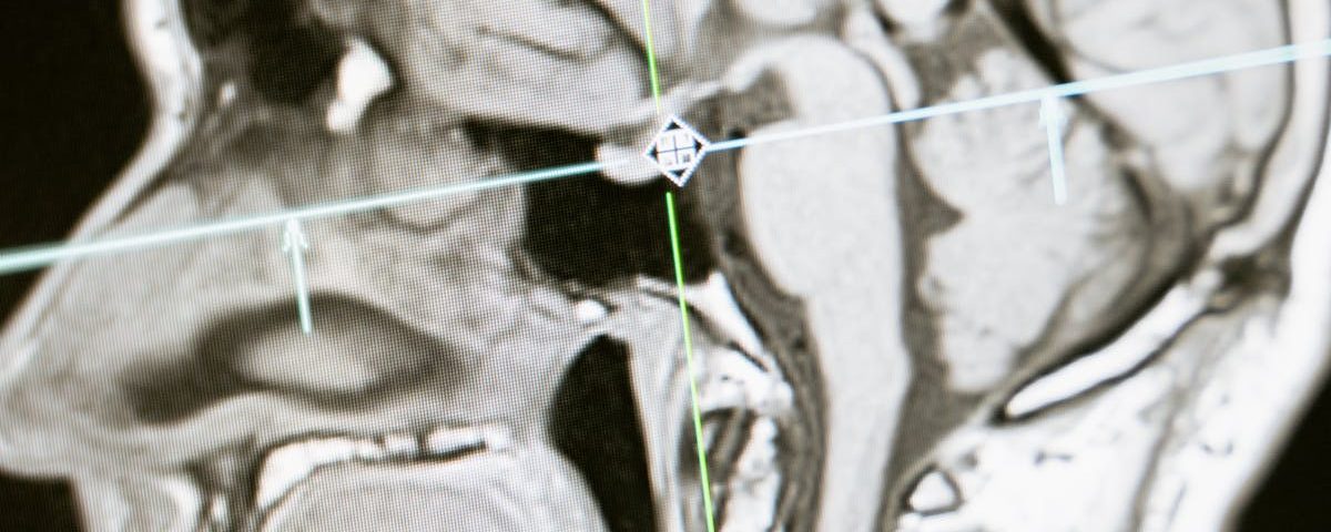 découvrez la médecine fonctionnelle, une approche holistique de la santé qui vise à traiter les causes profondes des maladies plutôt que de se concentrer uniquement sur les symptômes. améliorez votre bien-être grâce à des solutions personnalisées et des conseils sur la nutrition, le mode de vie et les interventions de santé naturelles.