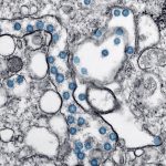 découvrez ce qu'est le microbiome, son rôle essentiel dans la santé humaine, et comment vous pouvez préserver l'équilibre de votre flore microbienne au quotidien.